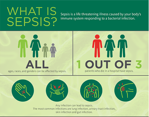 Sepsis Infographic top