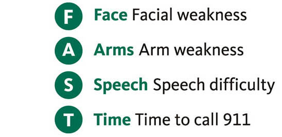 FAST stroke warning signs graphic
