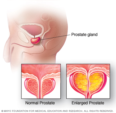 Prostate gland