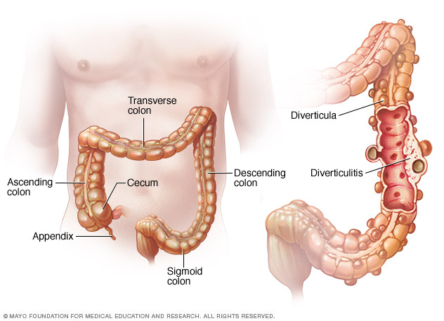 Pouches in digestive tract 