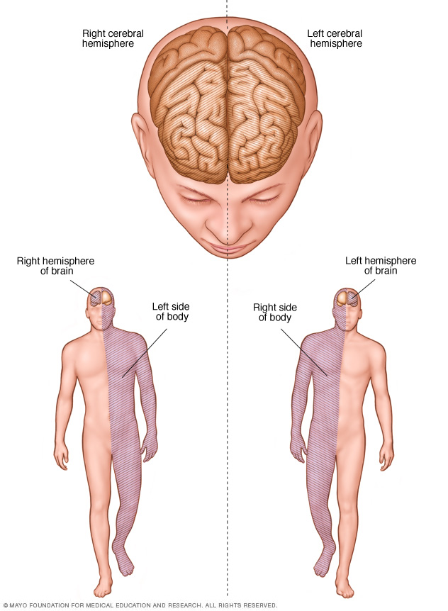 Brain hemisphere connections